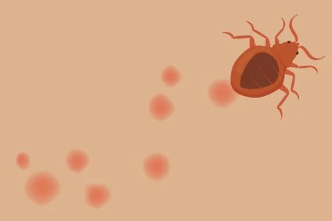 Bed Bug Crawling on Skin Leaving Red Bites Marks Stock Illustration