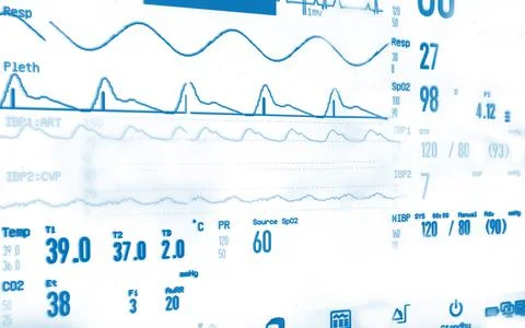 Bed side human  heart parameters measurement monitor display Illustrazione stock