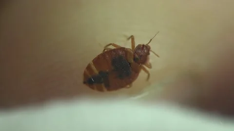 Bedbug insect parasite on human skin, macro Video stock 62275517