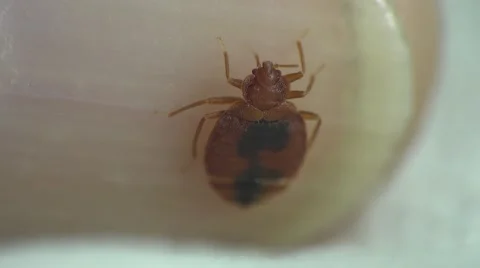 Bedbug insect parasite on human skin, macro Stockbeeldmateriaal 62275529