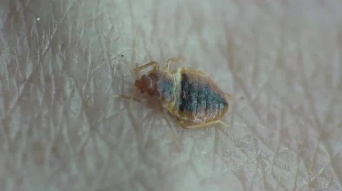 Bedbug insect parasite on human skin, macro Video stock 62275576