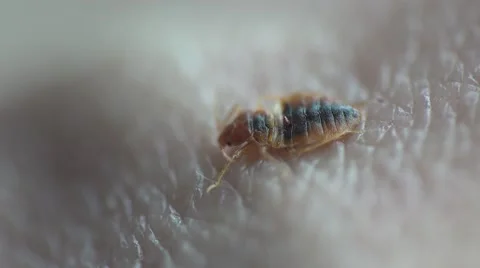 Bedbug insect parasite on human skin, macro Video stock 62275579