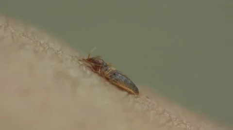Bedbug insect parasite on human skin, macro Video stock 62275580