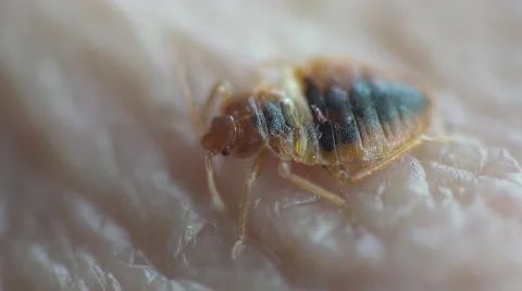 Bedbug insect parasite on human skin, macro Video stock 62275589