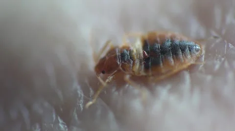 Bedbug insect parasite on human skin, macro Video stock 62275591
