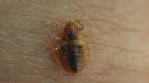Bedbug insect parasite on human skin, macro Stock-Footage 62275598