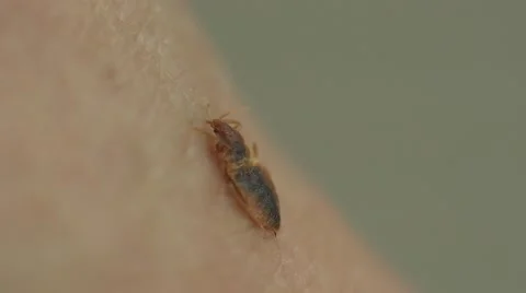Bedbug insect parasite on human skin, macro Video stock 62275602
