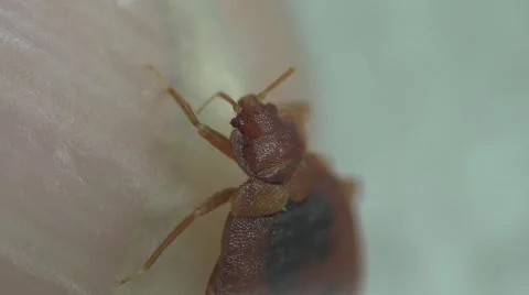 Bedbug insect parasite on human skin, macro Video stock 62275639