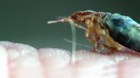 Bedbug sitting on human skin 動画素材 32866671