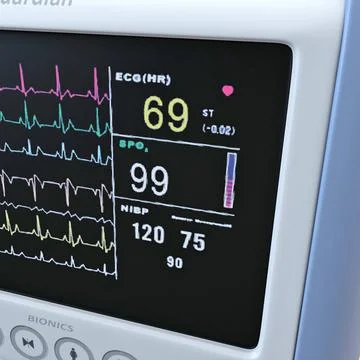 Bedside Patient Monitor ~ 3D Model #91482864 | Pond5