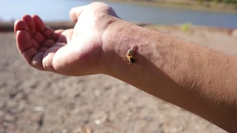 Bee sting. bees honey bee stinging a man.  treatment by bee sting.  bee worker Stock Footage 141427112