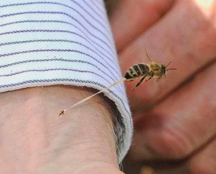 A bee sting on a human hand Stock Photos