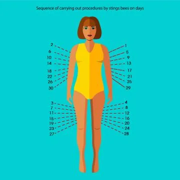 Bee sting Stock Illustration