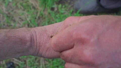 Bee sting therapy: The beekeeper places a bee with a visible stinger on his hand Stock Footage 310668009