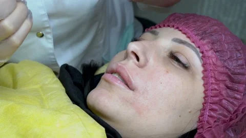 The beginning of the procedure of permanent lip makeup. Video stock 99821181