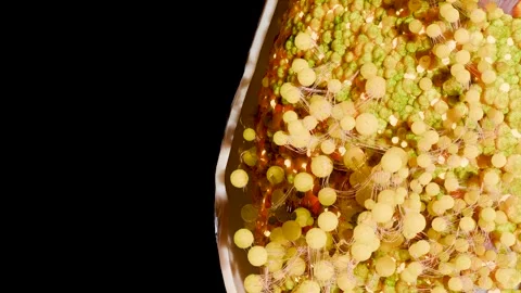 Belly fat burning process under the skin with realistic cross section of body Stock Footage 319438755