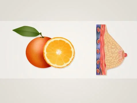 The benefits of oranges on the breast Stock Illustration