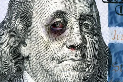 Benjamin Franklin on a 100 us bill with a black eye. The concept of the econo Stock Photos