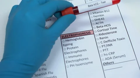 Beta hCG, doctor checking disease in lab blank, showing blood sample in tube Video stock 103448749