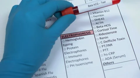 Beta hCG, doctor checking disease in lab blank, showing blood sample in tube Video stock 103451961