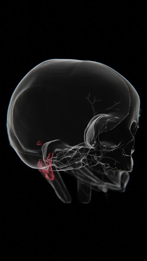 Bezold Absces indication video in Vertical format | Bezold Absces Video in X-Ray Stock Footage 322787235
