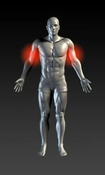 Bicep Injury Stock Illustration