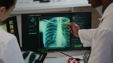 Bicultural Doctors Using AI Software Support while Analyzing X rays on Computer Stock Footage 332362017