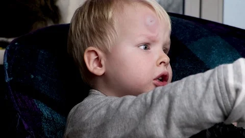 A big bruise on the forehead of a little boy Stock Footage 99366987