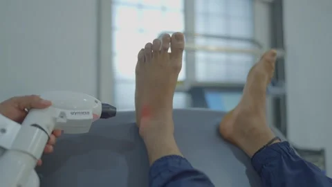 Biobase semiconductor laser checking with patient leg Stock Footage 312256096