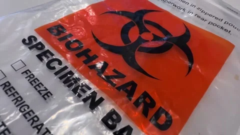 Biohazard Specimen Bag - Stable Shot Stock Footage 301337476