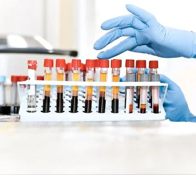 Biological material in test tubes. Hands of the laboratory assistant in gloves. Foto stock