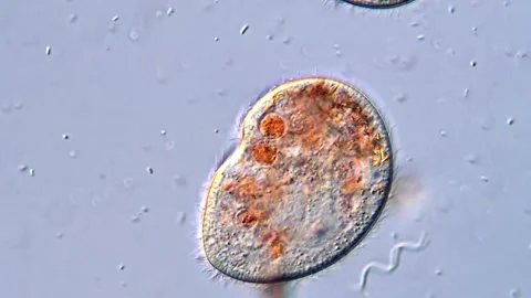 Biological Microscopy Video of Protozoa With Visible Cilia, 400x Video stock 318946163