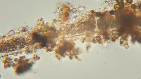 Biological research under a microscope of plant cells and unicellular primiti 库存影片 107724414