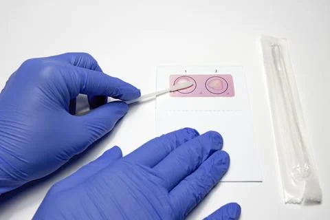 Biological sample collection using a cotton swab in a DNA analysis kit Stock Photos