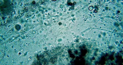 Biological Sample from Tree Trunk during Spring Flood showing Active Organisms Stock Footage 330956404