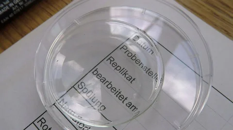 Biological sampling, picing, german text 스톡 동영상 68634888