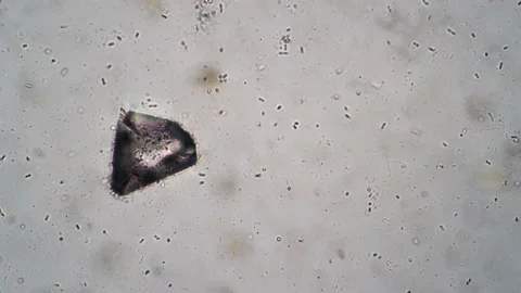 Biological studies under microscope of large cell and many small microorganisms Stock Footage 195551393
