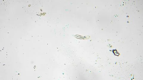 Biologist documents active swimming and feeding traces of protist in microscope Stock Photos