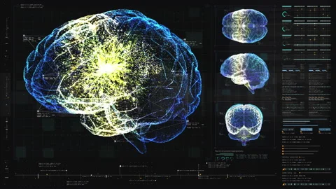 Biomedical Neuron Pathology And Diagnostic Scan Video stock 143332031