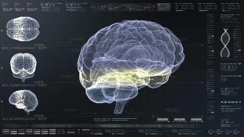 Biomedical Neuron Pathology And Diagnostic Scan Stock Footage 151493774