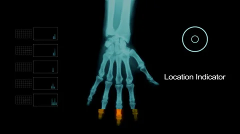 Biometric Scanning Hand Under X- Ray with other Elements Vidéo 39565858
