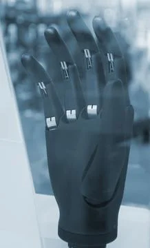 Bionic arm prosthesis. Plastic prosthesis printed on a 3D printer. Robotic arm. Foto stock