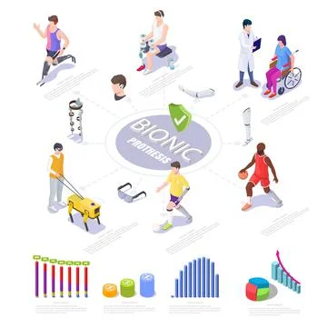 Bionic prosthesis isometric infographic, flat vector illustration. Disabled Stock Illustration