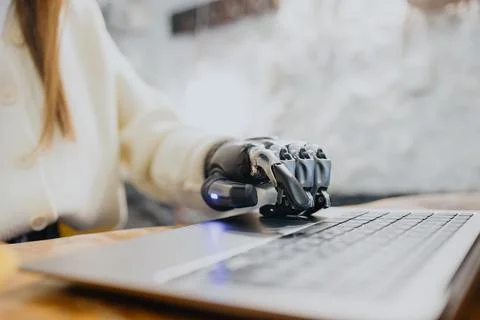 Bionic prosthetics, a woman with a bionic prosthetic arm and forearm is working Stock Photos