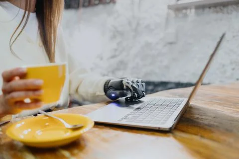 Bionic prosthetics, a woman with a bionic prosthetic arm and forearm is working Stock Photos