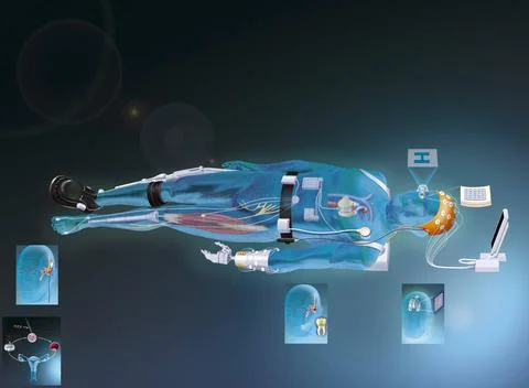  Bionics Bionic man. Representation of various current and considered impl... Stock Photos
