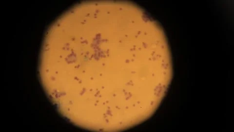 Biopsy. biopsy results under a microscope. Anatomical theme. Stock Footage 258062357