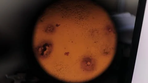 Biopsy. biopsy results under a microscope. Anatomical theme. Stock Footage 270180720