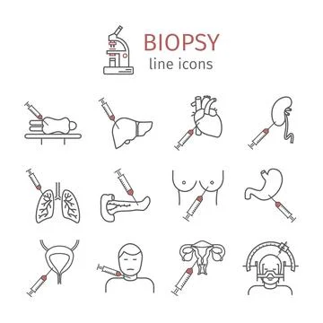 Biopsy: Types of biopsy procedures used to diagnose cancer Stock Illustration