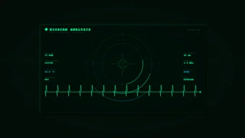 Bioscan Analysis Interface Showing Heartbeat Scan Complete for Medical Tech.. Stock Footage 337092593